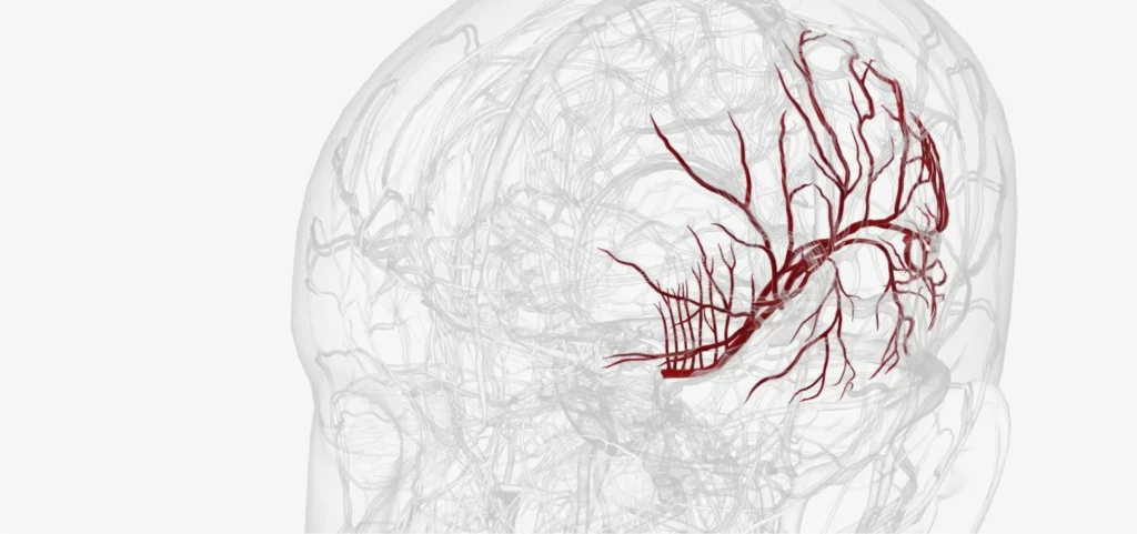 Early Detection of Stroke Risk with AI_SuccessStories_inteliment.com